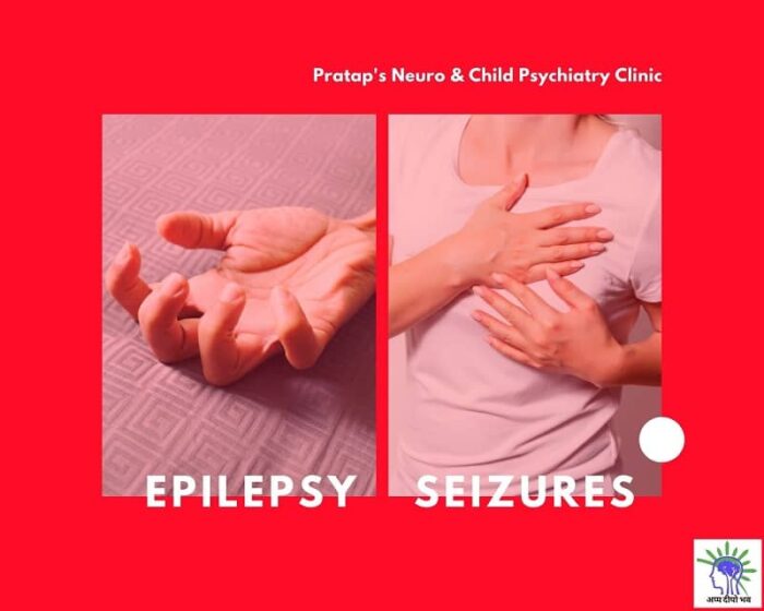 Difference Between Epilepsy And Seizures 5785