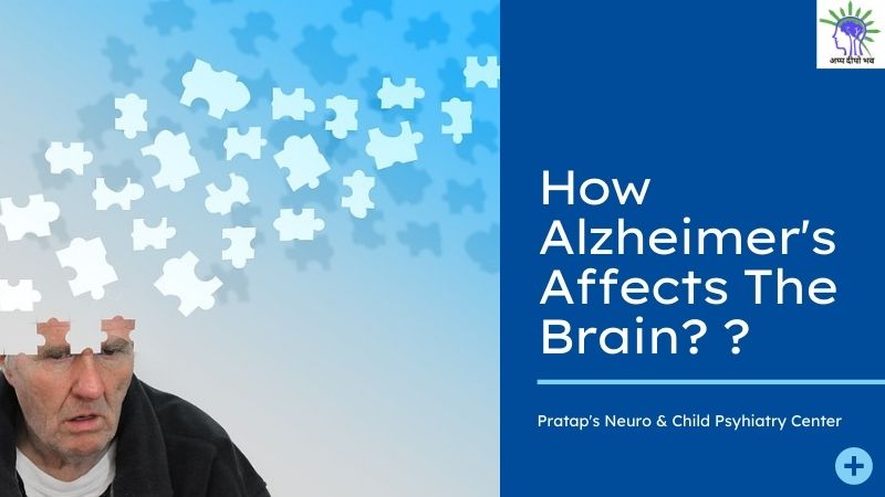 How Alzheimer's Affects The Brain